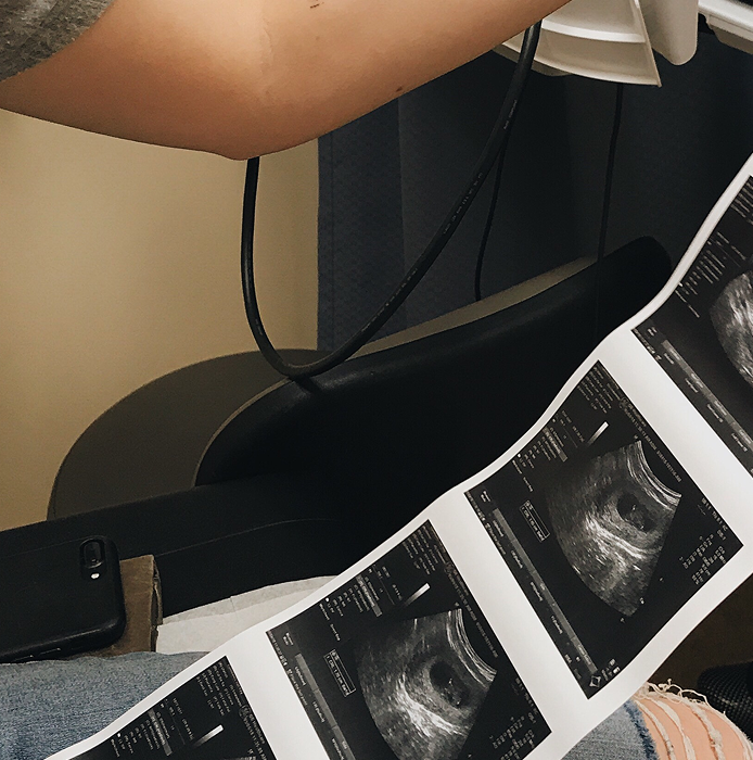 urban-portrait-of-a-modern-pregnant-latina-woman-2025-02-25-14-12-32-utc 1