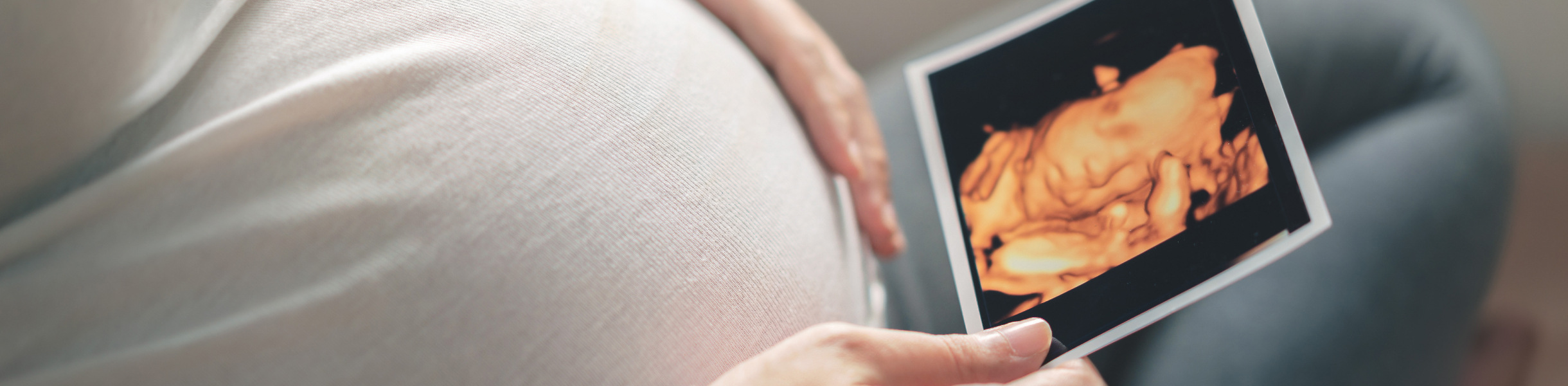 Banner_4D Scan Essential@2x